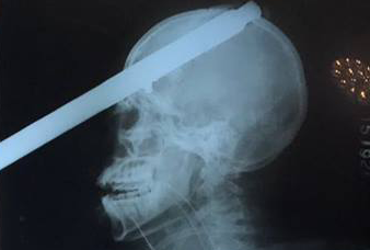 Generic placeholder image