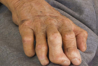 Generic placeholder image