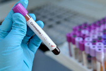 Generic placeholder image