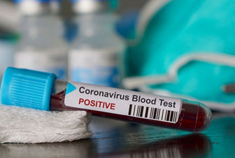 Generic placeholder image