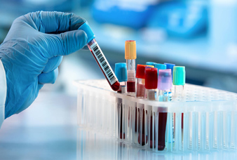 Generic placeholder image