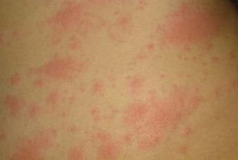 Generic placeholder image