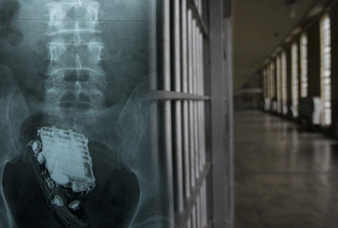 Generic placeholder image