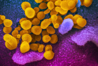 Generic placeholder image