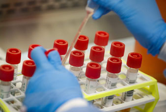 Generic placeholder image