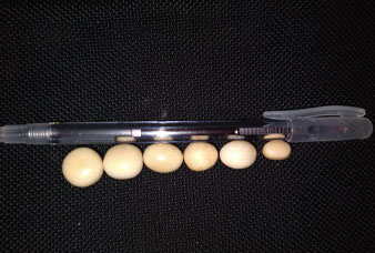 Generic placeholder image