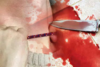 Generic placeholder image