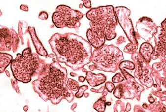 Generic placeholder image